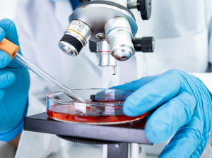Accedete a campioni biologici umani per la vostra ricerca oncologica!