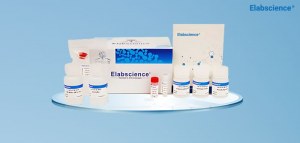 Économisez 15% sur toutes les protéines recombinantes d'Elabscience!