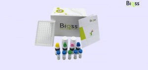 Bénéficiez de 30 % de réduction sur les anticorps monoclonaux pour l'immunohistochimie de Bioss